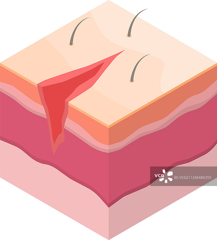 外科缝合线2.5D风格图标图片素材