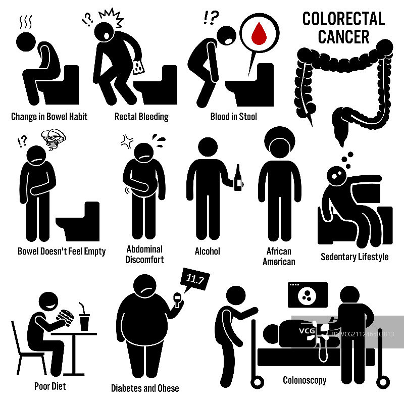 结肠直肠结直肠癌症状图片素材
