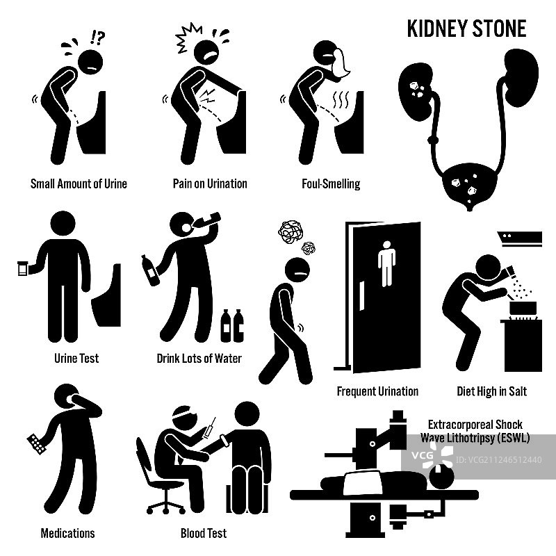 肾结石图标和图表图片素材