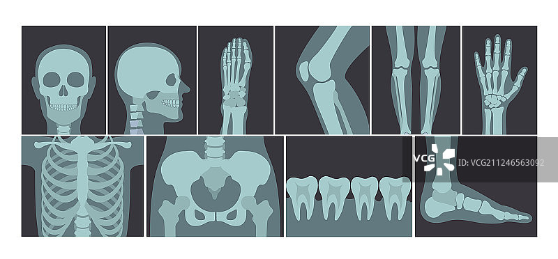 X光照片合集图片素材