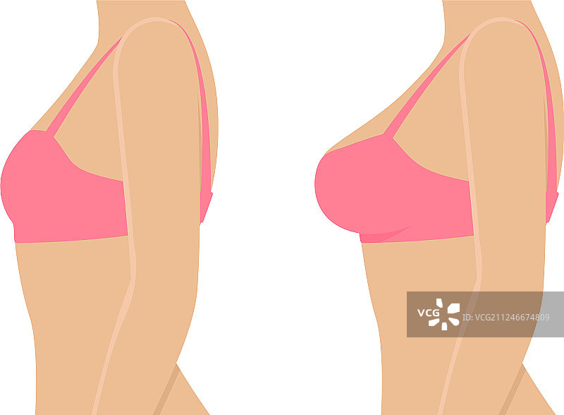 女性穿内衣隆胸前后对比图片素材