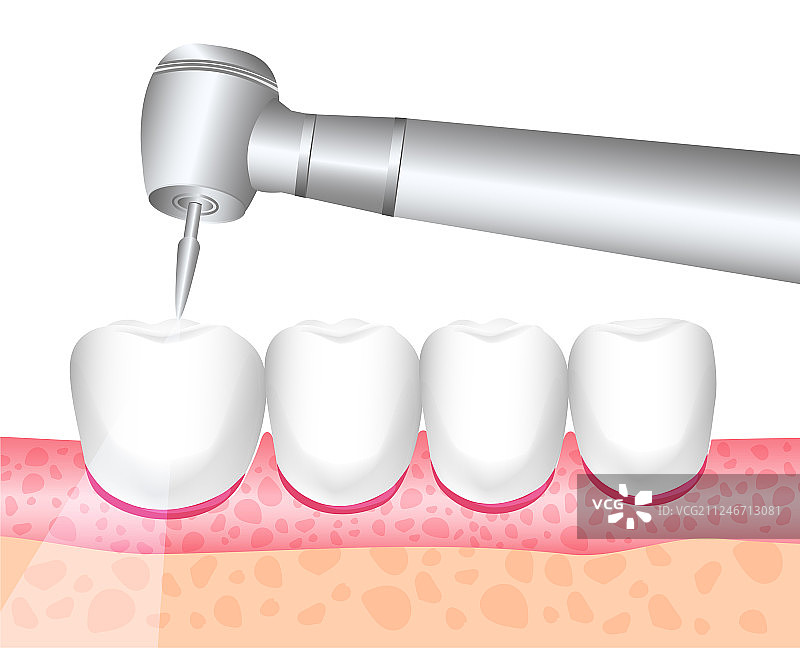 牙科牙齿美白护理图片素材