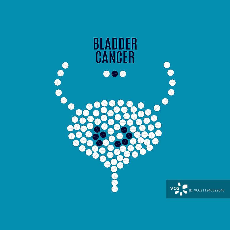 膀胱癌药丸医疗海报图片素材