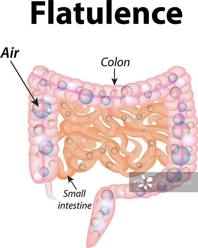 小肠内的肠胃胀气图片素材