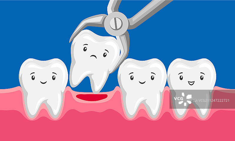 口腔中用镊子拔牙图片素材