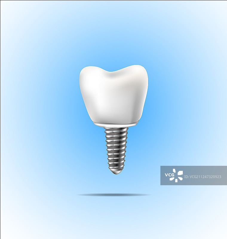 健康的牙齿和牙科植入物图片素材