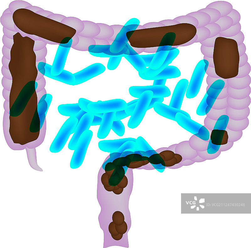 用益生菌治疗便秘图片素材