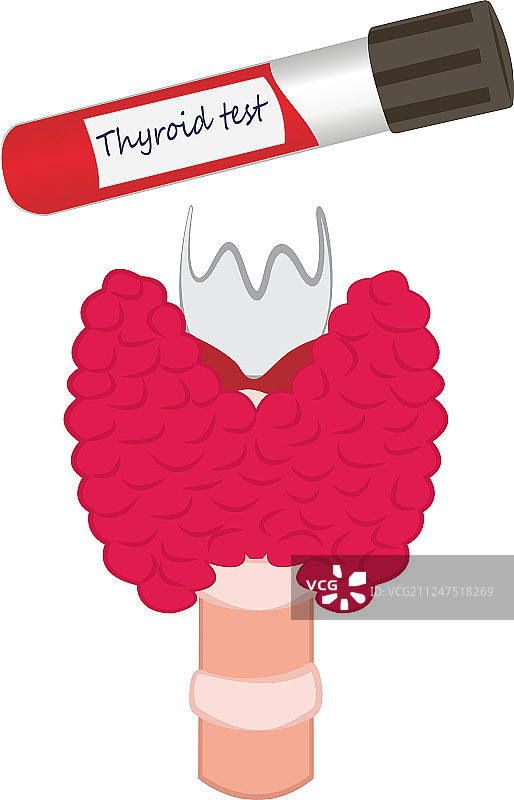 甲状腺试管诊断技术图片素材