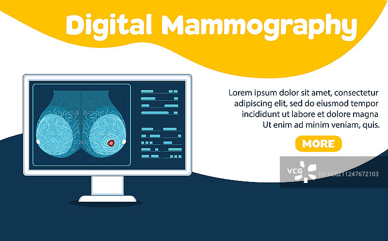 数字乳腺X线摄影banner图片素材