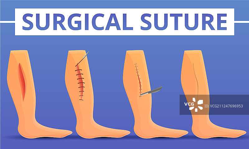 医疗缝合概念背景卡通风格图片素材