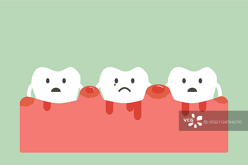牙周炎与出血图片素材