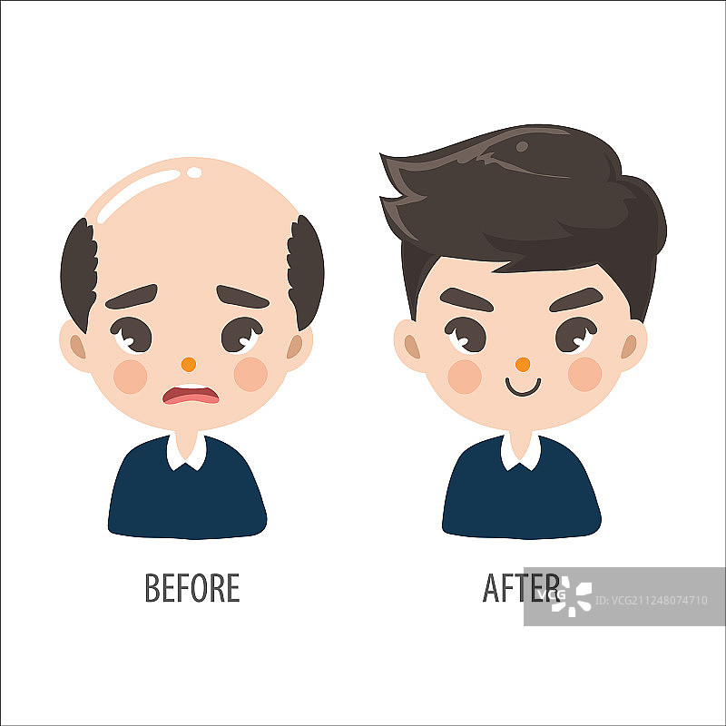 没有自信的秃顶男人和长发男人图片素材