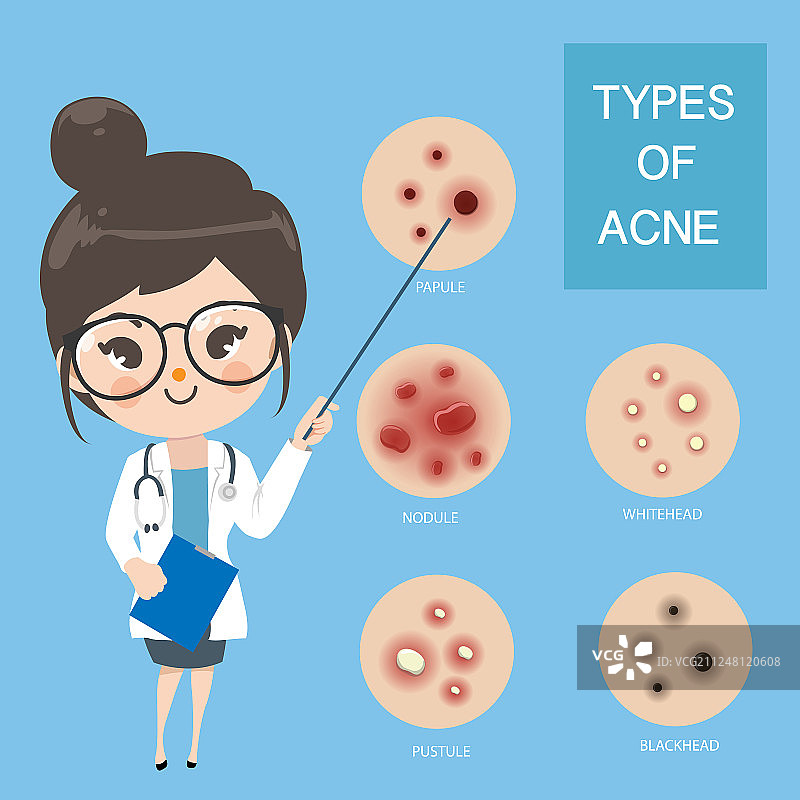 医生推荐典型痤疮图片素材