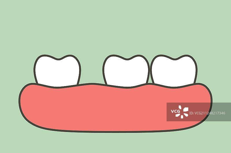 牙齿间隙或齿缝图片素材