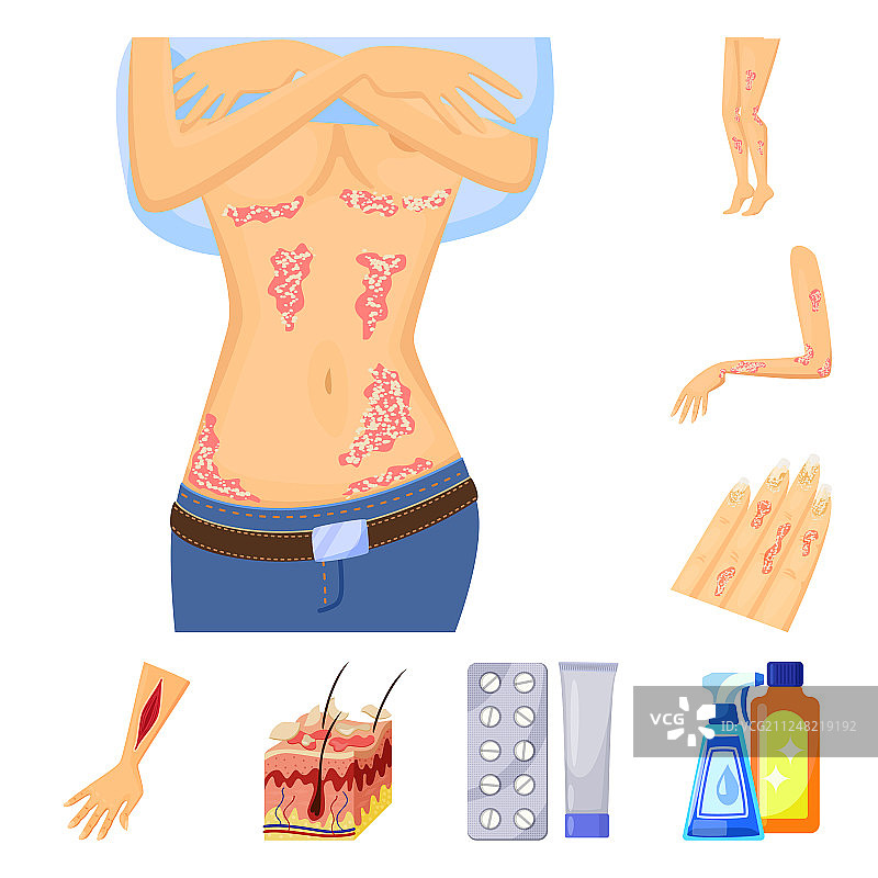 皮肤科疼痛设计符号集图片素材