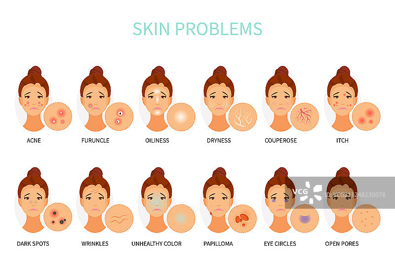 皮肤问题图片素材