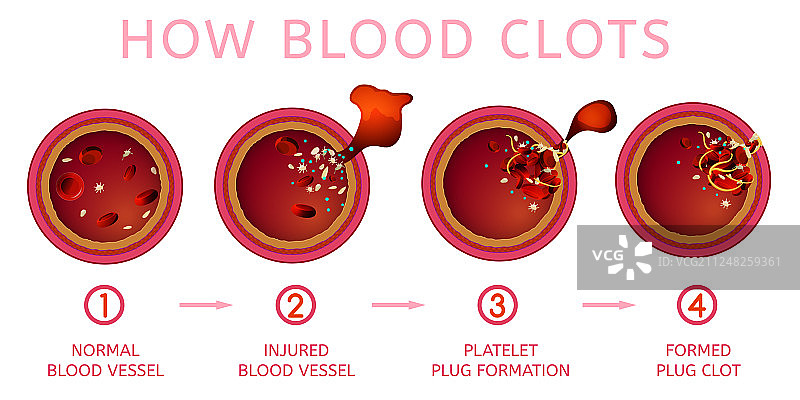 血液凝结过程图片素材