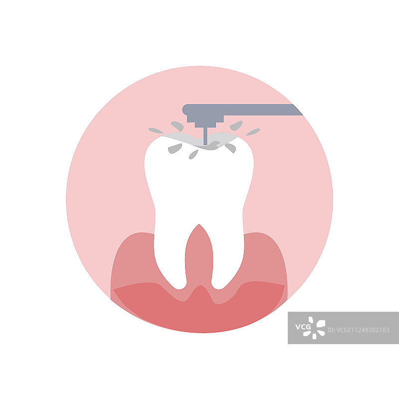 牙齿钻孔过程（扁平风格）图片素材