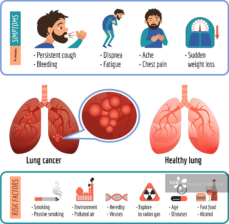 卡通风格的肺部信息图图片素材
