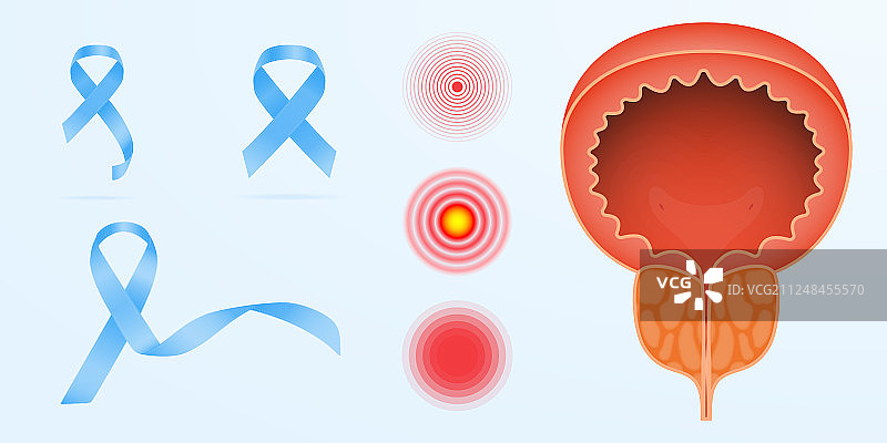 前列腺癌彩色图标：男性生殖系统图片素材