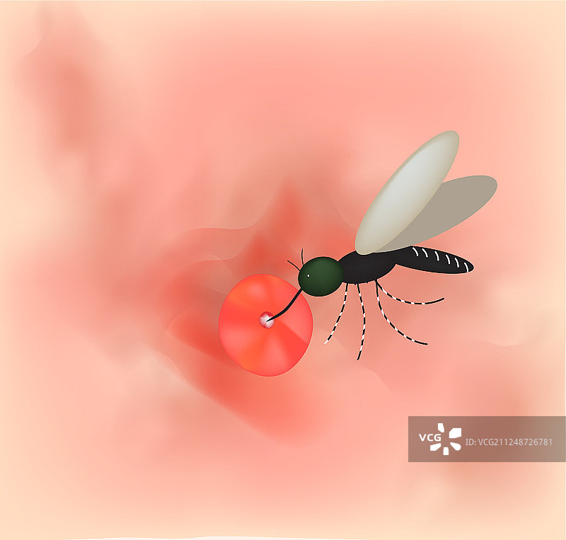 世界蚊子日：皮肤上的蚊子叮咬图片素材