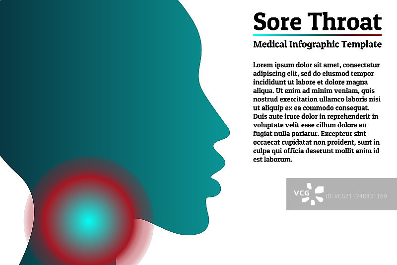 医疗信息图表模板-咽喉疼痛图片素材