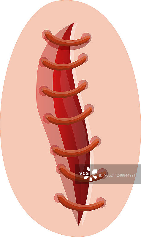 打开的缝合线图标卡通风格图片素材