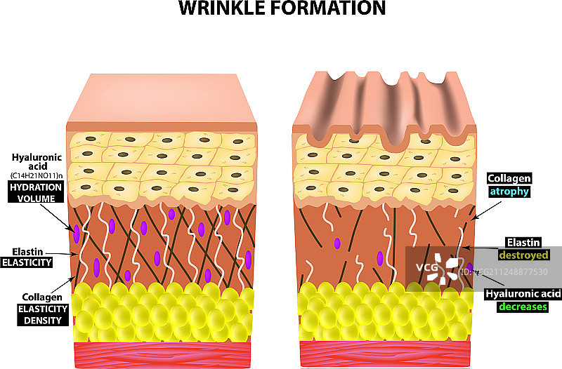 皱纹的外观解剖结构图片素材