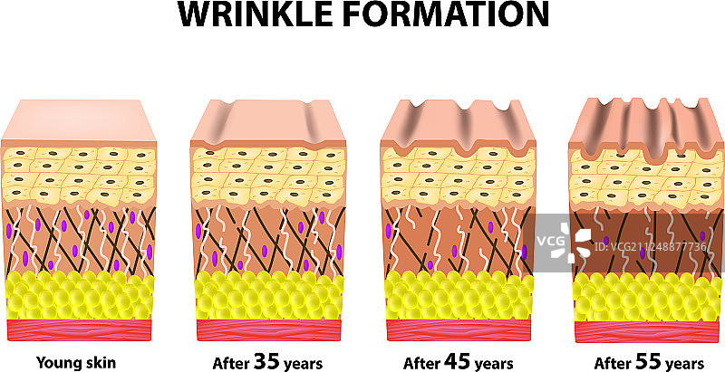 不同年龄阶段的皱纹解剖图图片素材