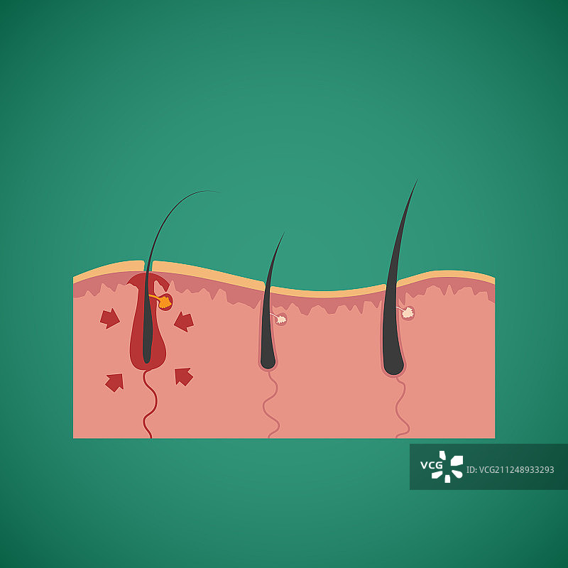 护发及生长营养概念图片素材