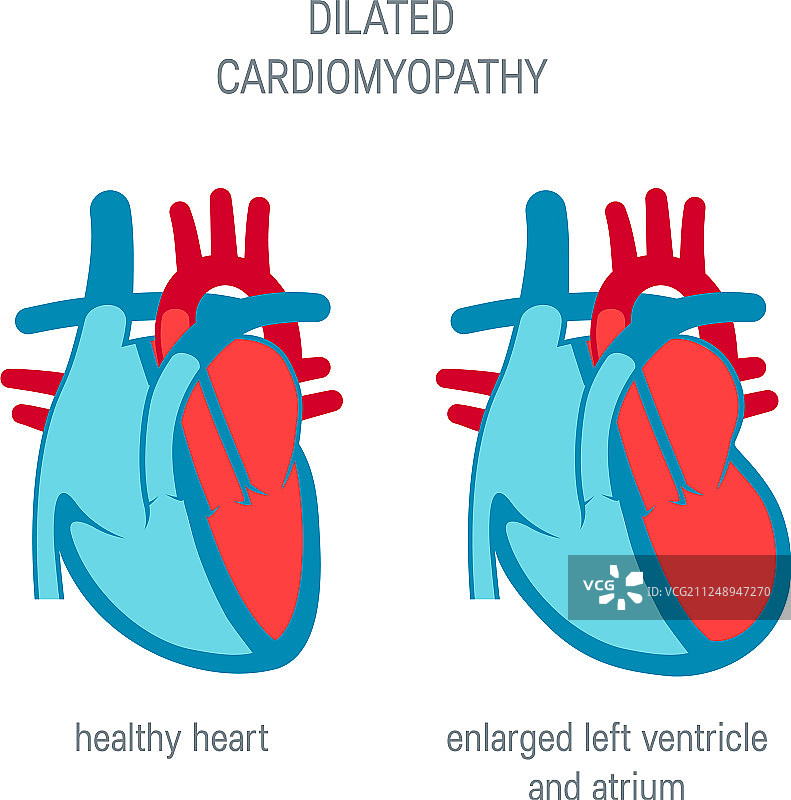 扁平风格的心脏疾病概念图片素材