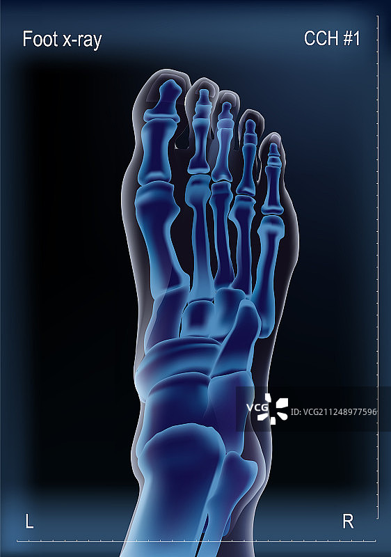 足部骨骼的X光片图片素材