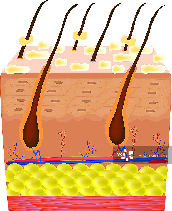 脂溢性皮炎皮肤和头发头皮屑图片素材