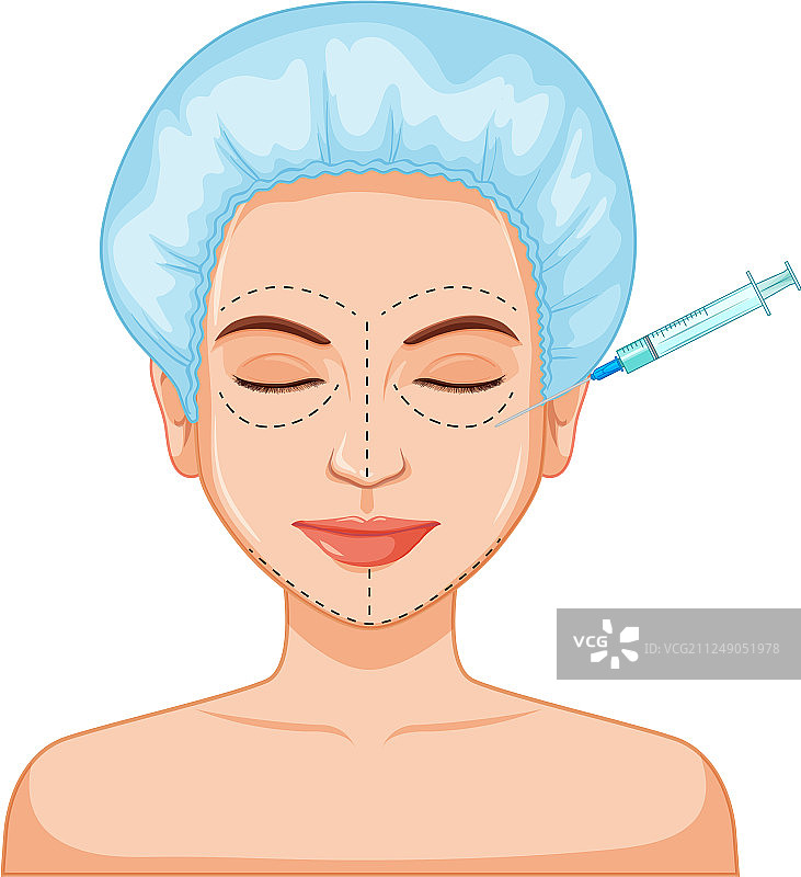 女士肉毒杆菌填充皮肤注射图片素材
