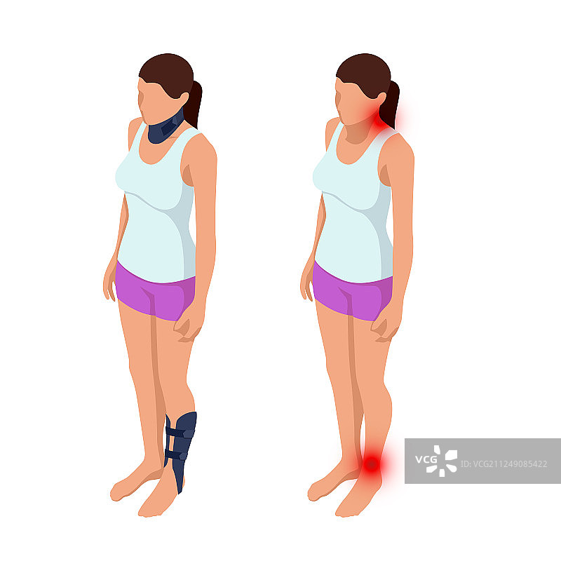 可调节的骨骼损伤固定器图片素材