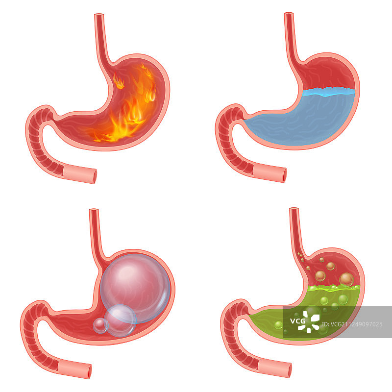 逼真的胃部医疗图图片素材