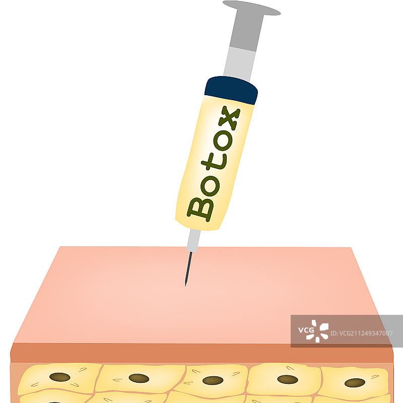 皮肤上的皱纹：肉毒杆菌除皱护理图片素材