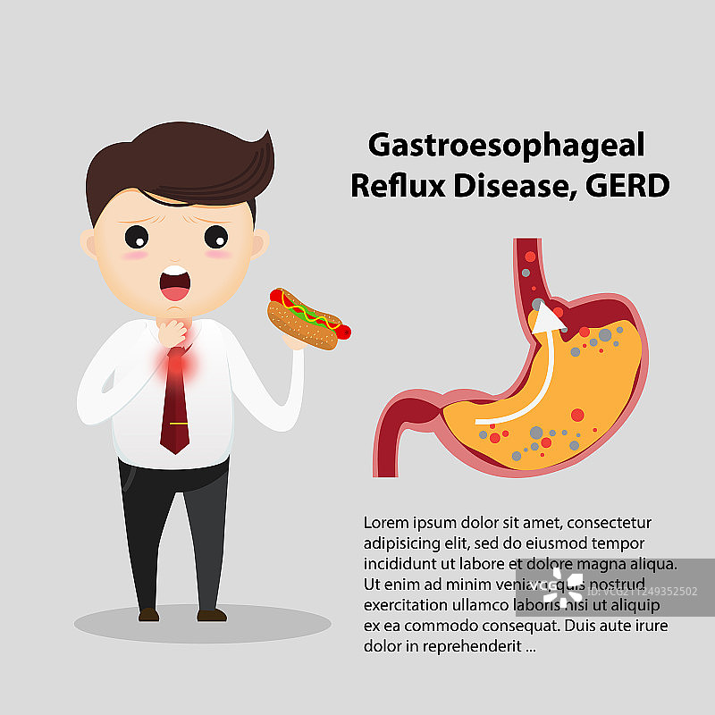 胃食管反流病图片素材