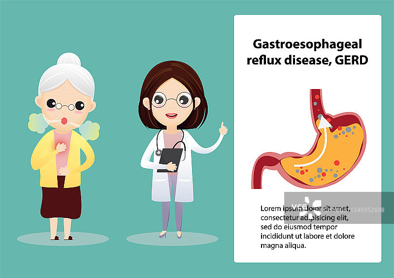 胃食管反流病图片素材