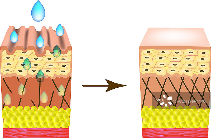 皮肤皱纹与胶原蛋白流失的影响图片素材