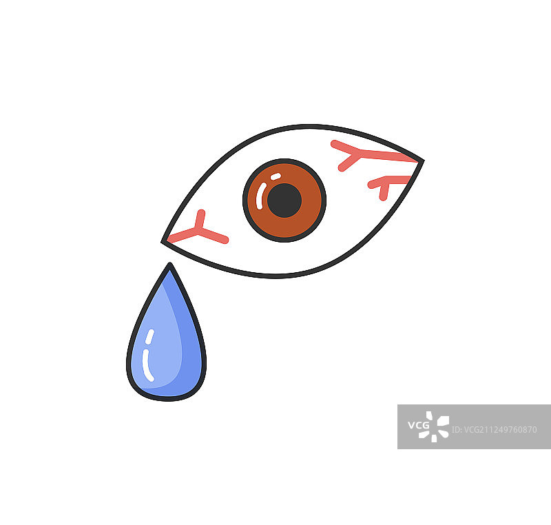 过敏反应症状：充血的眼睛图片素材