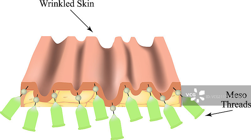 面部提升的美容线材图片素材