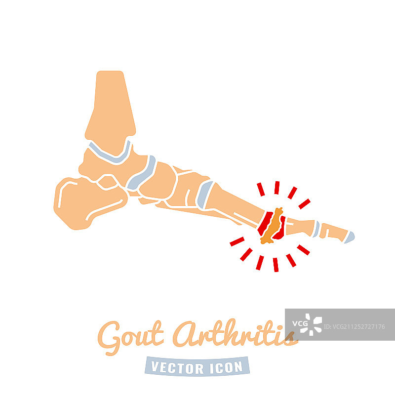 痛风性关节炎图标图片素材