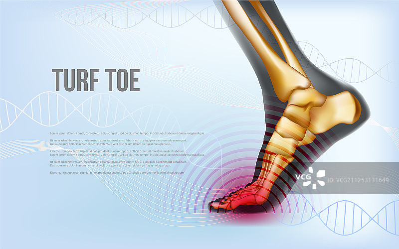 草皮脚趾足部损伤横幅图片素材