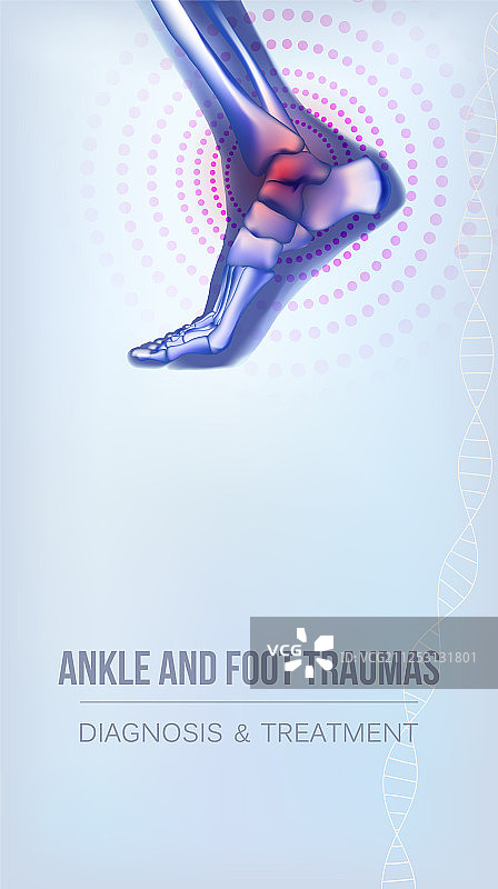 脚踝和足部创伤banner图片素材