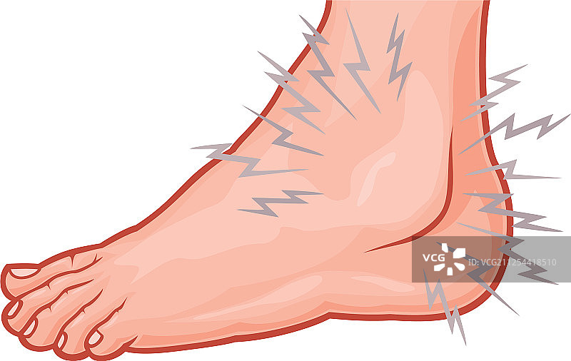 脚踝扭伤图片素材