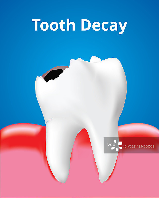 牙龈发炎的龋齿牙科护理概念图片素材