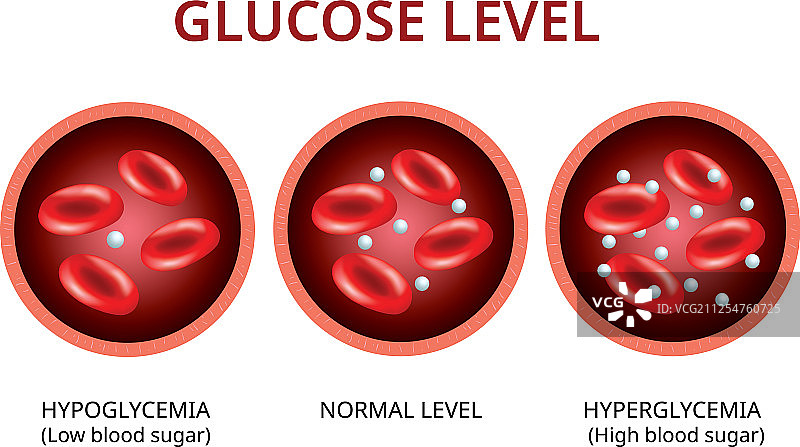 血管中的血糖水平正常值图片素材