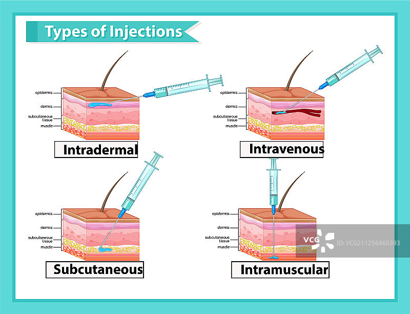 医学注射类型图片素材