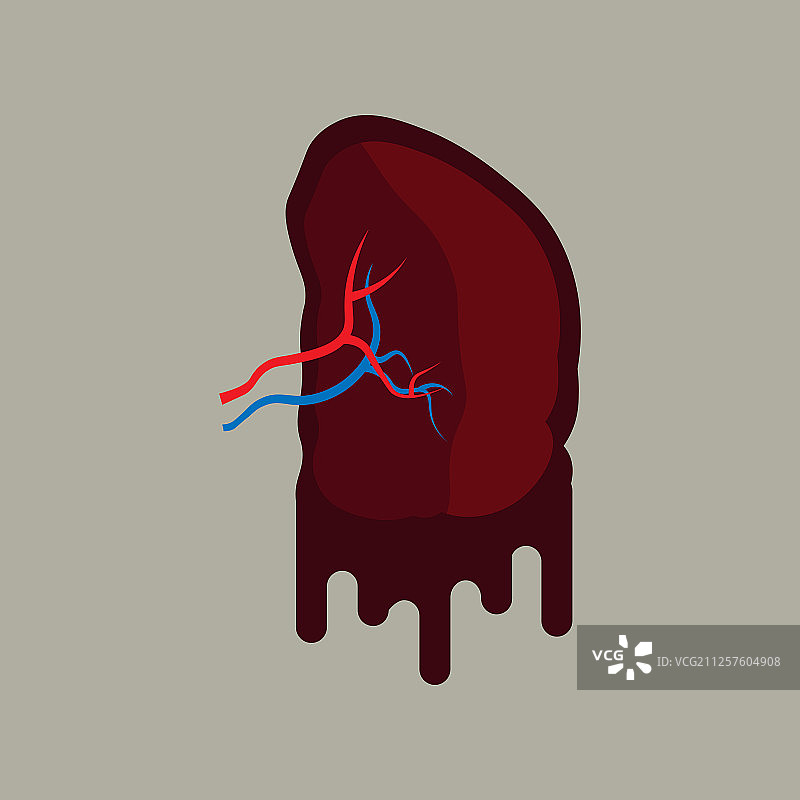 脾脏脓肿囊肿疾病卡通图片素材